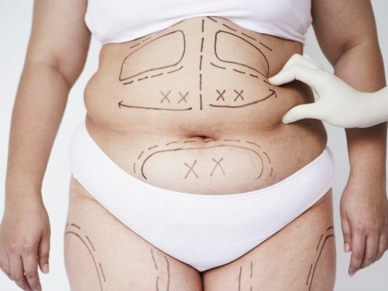 Modern Body Contouring Methods